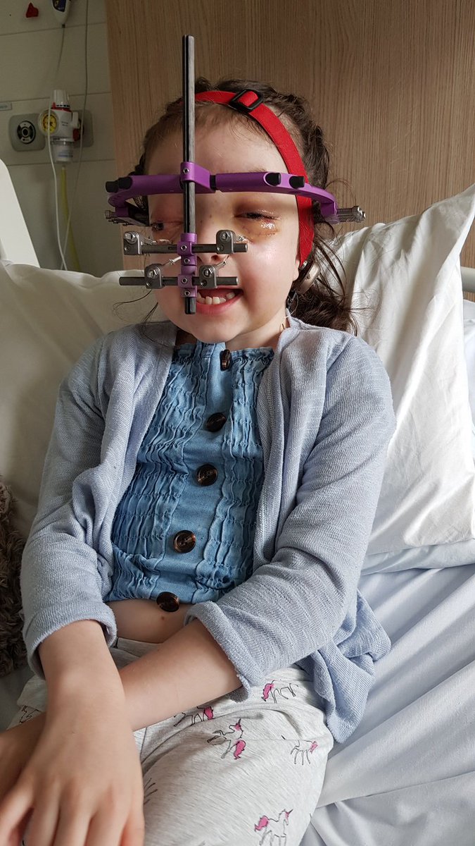 AlderHey's tweet photo. Meet 8yo Abigail 👧 who was born with Crouzons Syndrome, a condition that causes premature fusion of the skull. Abigail recently had surgery here &amp; despite everything she's been through, she still has a smile on her face 😃 Well done Abigail, you're so brave! #FridayFeeling https://t.co/AEX5CII1HR