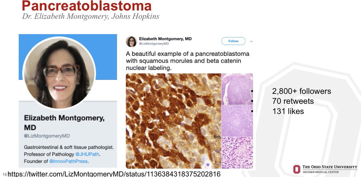 MArnold_PedPath's tweet photo. If you are looking for great #pathology cases from a world expert, you need to follow @LizMontgomeryMD!#SocialMediaDay #PathEd #NCHPath @OSUWexMed @NCHforDocs https://t.co/0lza8bK6QO