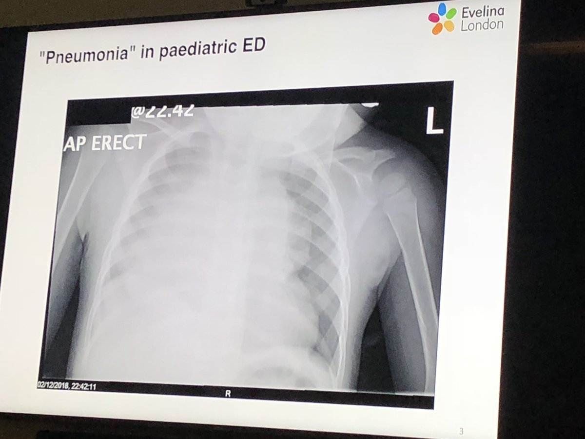 STRS_Evelina's tweet photo. What do you do when faced with a child with respiratory distress & a #CXR like this in #PedED #PedsICU?
#STRStips #FOAMed #FOAMPed https://t.co/uArdNWmOpA