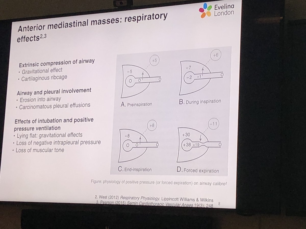 STRS_Evelina's tweet photo. ...and be aware of #Respiratory #Haemodynamic & #Vascular pitfalls when considering #intubation
#STRStips #PedsICU #Anasthetics #FOAMed #FOAMPed https://t.co/aEB9Yp5KkE
