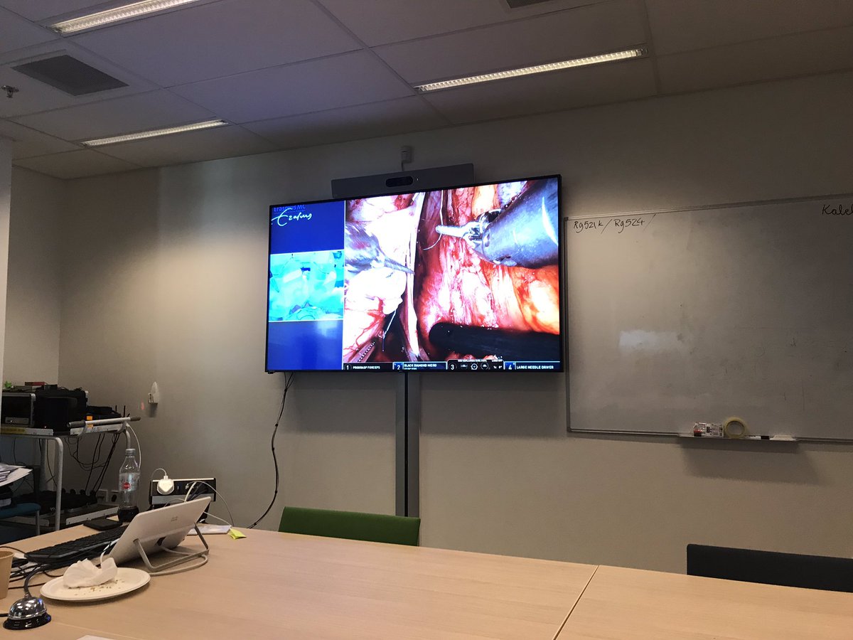 Live online operations from OR at LIDO course. Three challenging donor nephrectomies and transplants. Robotic kidney transplantation from Karel Decaestecker. Excellent online demonstration at the last day.
#ESOT4edu #PoweredByESOT @frank_dor @KessarisN @DKimenai  @gabriel_oniscu