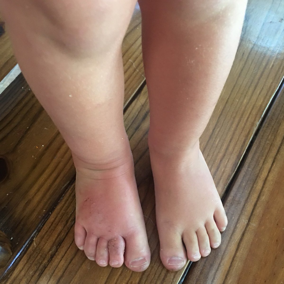 Jayklin1's tweet photo. Prayers please! Headed to the doctor because I got stung by a bee two days ago and my foot continues to swell up into my leg😢 https://t.co/XcgJTo524d