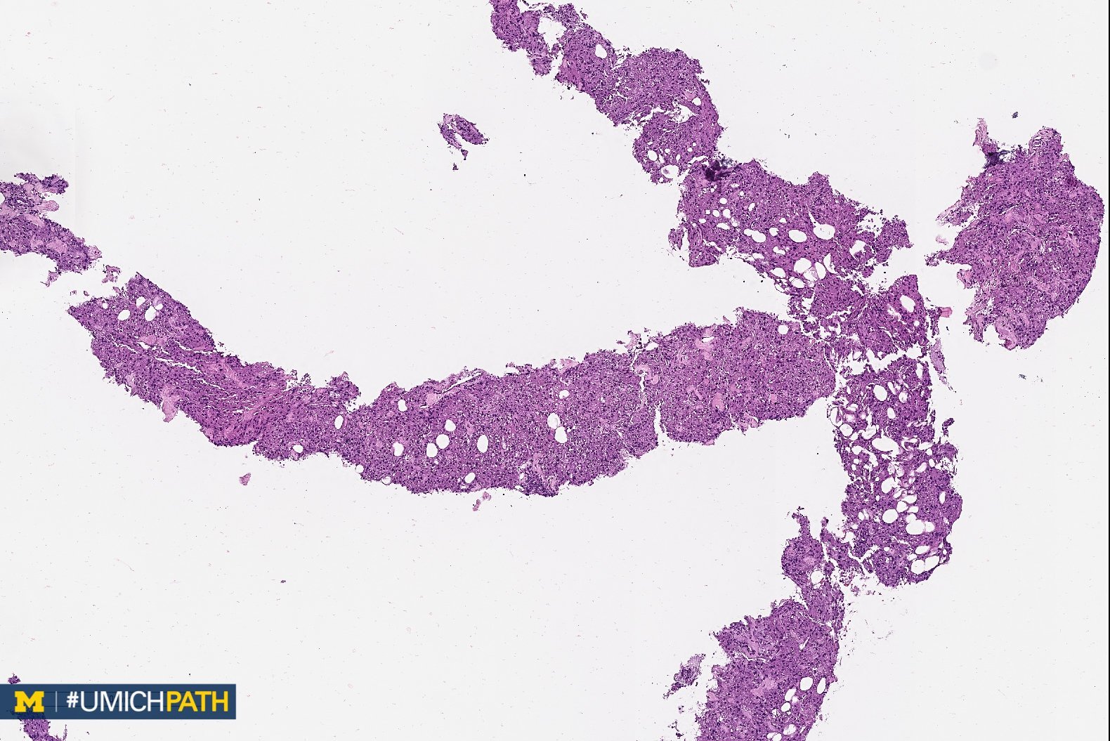Michigan Pathology on Twitter "codyscarter WilliamRPerry3