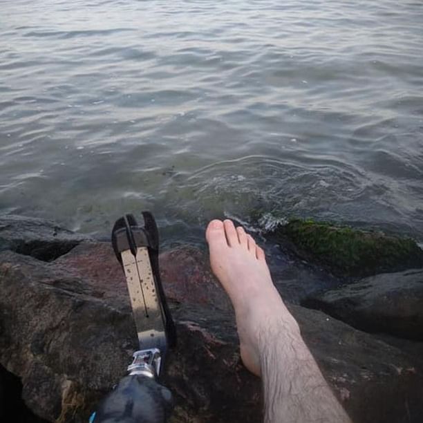 Чи замислювалися над тим,скільки ветеранів російсько-української війни втратили на Донбасі кінцівки? Як вони живуть тепер?Як продовжують службу у ЗСУ з протезами замість рук чи ніг?Хлопець,чиї ноги ви бачите на фото,попри важке поранення,продовжує боротися,щоб ми могли мирно жити