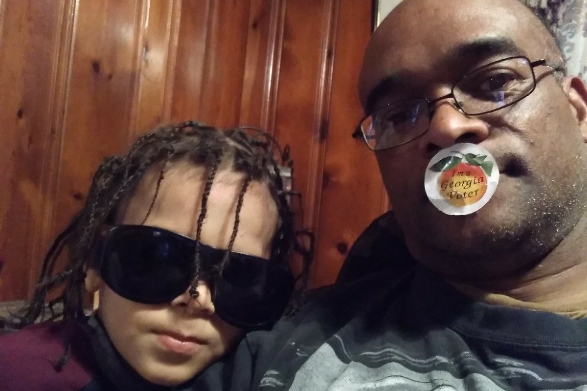 iammedia's tweet photo. Nephew from this to this about I guess 3 week ago now, but he's much better now. And is healing from surgery. https://t.co/iDWcmM854O