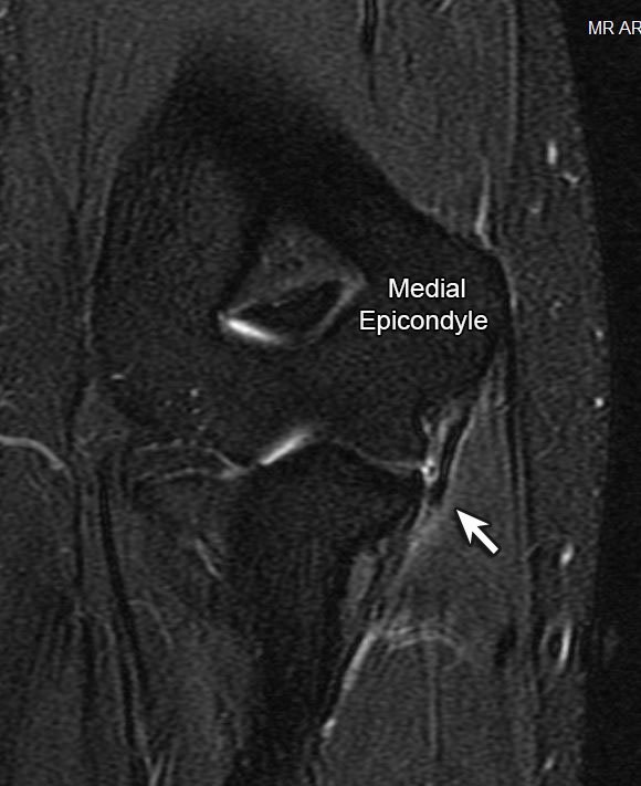 Jon A. Jacobson, MD FACR tweet media