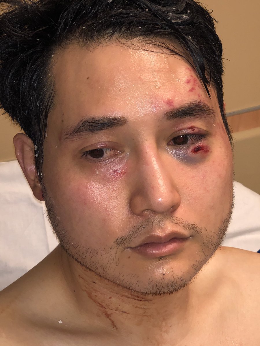 Antifa terrorists assault journalist Andy Ngo in Portland - injuries to face, neck, ears - media silent
