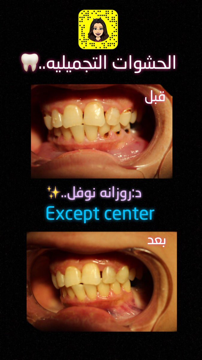 expertscenter1's tweet photo. _•
#مجمع_خبراء_التخصصي 
السويدي مخرج ٢٧
شارع عبدالرحمن الفريان📍

فتح ملف+كشف+الاستشارة=مجانا 
لحجز ومواعيد والاسفسار •01143333382 -
•0531232821
#ليلة_سهم #يهمني_انك #الرَسآئل_القَديّمة #كازاخستان #الخادمه_دانيش https://t.co/tCsrQKzwkS