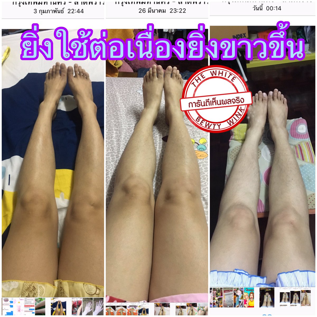 NNaramol's tweet photo. อยากขาวเนียน ขาวไว ขาวแบบเร่งด่วนเห็นผลใน1เดือน ต้องโลชั่นเดอะไวท์เลย ทาเป็นประจำเช้าเย็น ใครอยากเปลี่ยนผิวให้ขาวขึ้นทักมาค่ะ 
200ml. 750บาทส่งฟรี (ใช้ได้นานเป็นเดือน)#HowtoPerfect #อยากขาว #ของดีบอกต่อ #ดำแค่ไหนก็ขาวได้ #ผิวขาว https://t.co/J8GqkWJBvW