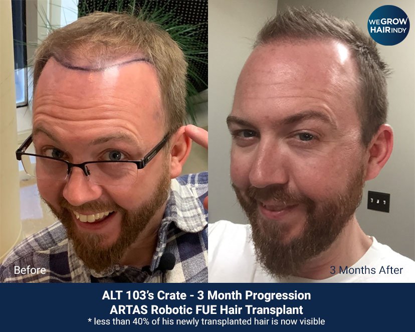 We Grow Hair Indy on Twitter: We Grow Hair Indy on Twitter: