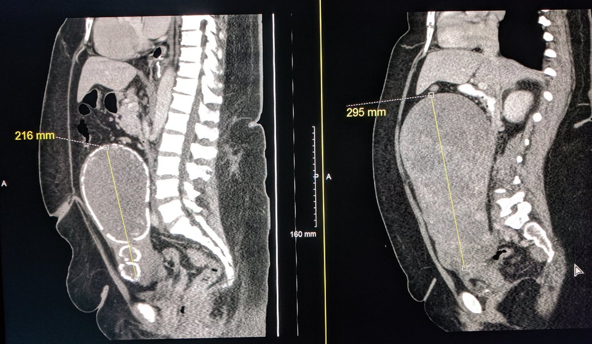 Olga R Brook, MD, FSAR, FSIR, FSABI, FESGAR tweet media