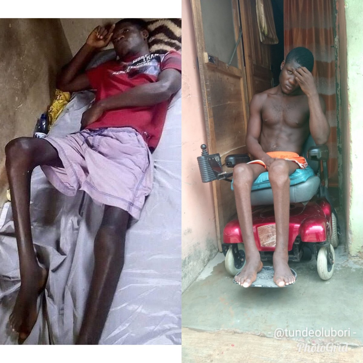 <a href="/BBNaija/">Big Brother Naija</a> Please I beg everyone to come to my rescue I came across a robbery bus at oshodi and I was shot at my backbone and the doctor suggested a surgery but money causes delay. Pls help me in any little way. Am not happy sitting on chair all day in pain .🙏 pls help me am dying 🙏🙏🙏