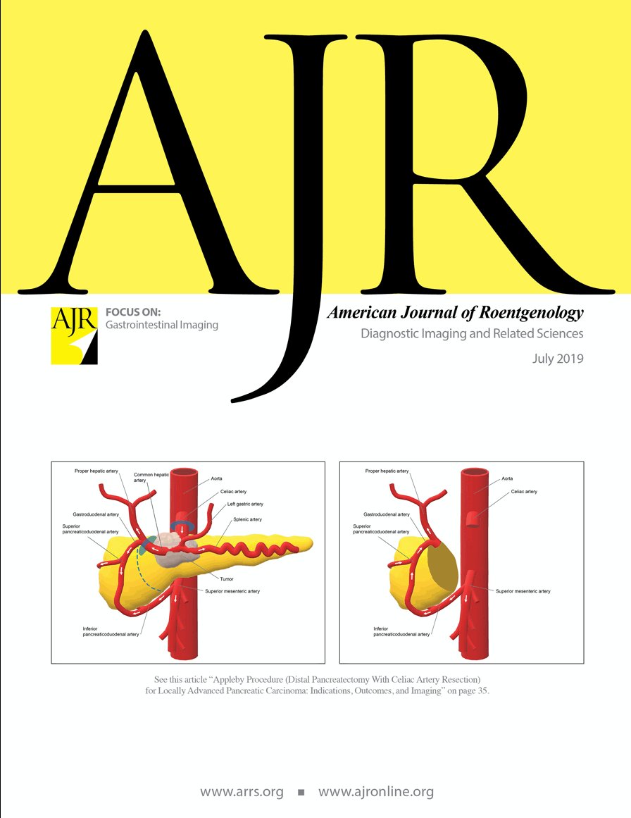 Appleby Procedure (Distal Pancreatectomy With Celiac Artery Resection) for Locally Advanced Pancreatic Carcinoma is now published on the July issue of AJR (American Journal of Roentgenology. 2019;213: 35-44) <a href="/ARRS_Radiology/">ARRS</a> 
ajronline.org/doi/abs/10.221…