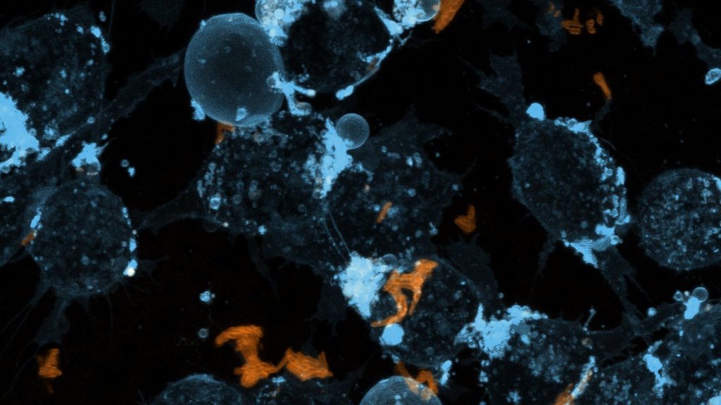 inflammafish's tweet photo. Trying out #Lipilight #MemBright on Raw macrophages (cb skyeblue) infected with Mycobacteria (cb orange). A lot to improve but I can see already beautiful cell structures @IdylleLabs
LUTs from @christlet https://t.co/LaulXvcuui