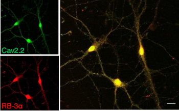 TheWeissLab's tweet photo. Novel regulation of neuronal #calcium #ionchannels by Rabconnectin, fresh from the #zamponi lab ➡️ https://t.co/ldTefEQTJC https://t.co/sgRmM3D9l1
