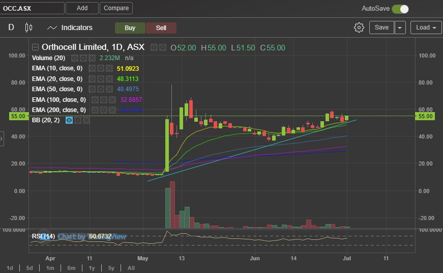 sns_trader's tweet photo. $OCC
Slowly uptrending
Sitting above 10 MA
The fact that it hasn't dropped this level might show that big holders are expecting more?
IMO
DYOR https://t.co/J2CFaay1rs