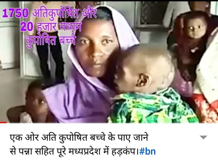vinodkureley's tweet photo. बेरोजगारी की मार झेल रहा पन्ना जिला कुपोषण में बाकी जिलों को पीछे छोड़ चुका है। भारतीय न्यूज़ के अनुसार 1750 गंभीर कुपोषित, एवं 20,000 बचे माध्यम कुपोषित पाए गए। यह आंकड़ा जिम्मेदारों को शर्मसार क्यो नही करता। कब सुधरेगी व्यवडताएँ। @OfficeOfKNath @messagesachin @Yousufbeg3 https://t.co/Gb4xLYlwk8