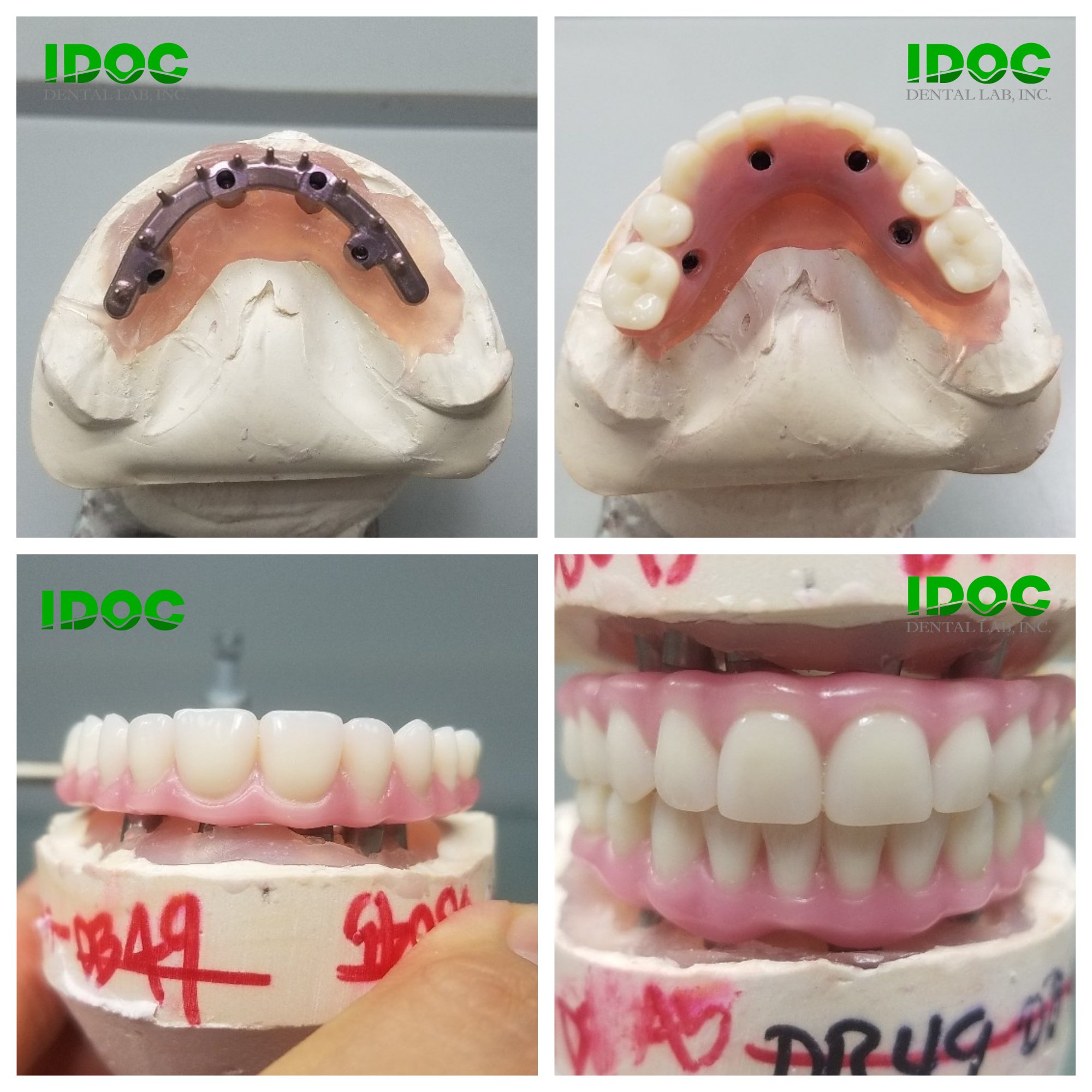 IDOC Dental Lab (IDOCdentalLab) / Twitter