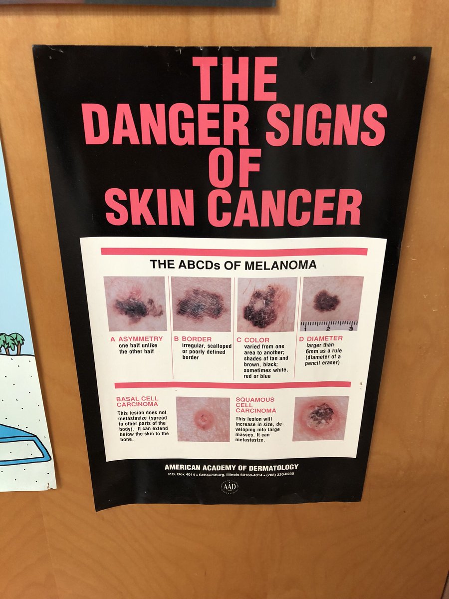 This is my biannual #PSA. Please get yer freckles & moles checked once or twice a year by a dermatologist!  And wear sunscreen and a hat!  It’s EASY to avoid skin cancer!  I did have one barnacle burned off the side of my face. But that’s an AGE thing! 🙃 #PreventSkinCancer