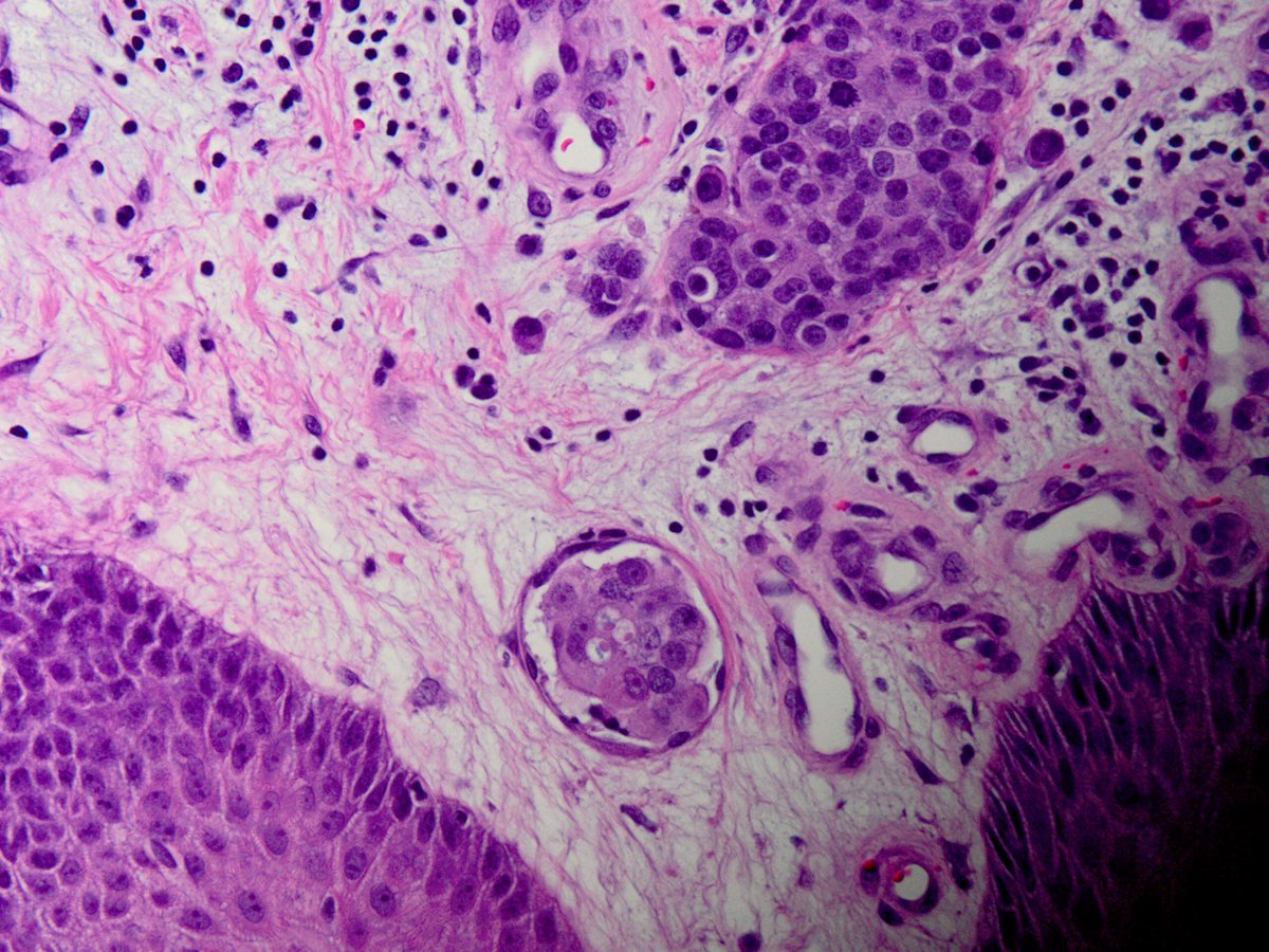 Israh Akhtar Khan tweet media