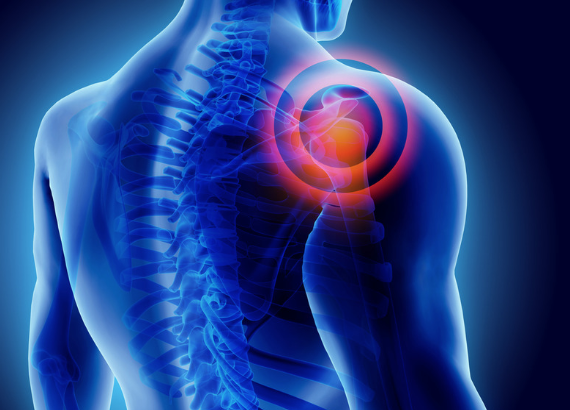 MillettMD's tweet image. Did You Know?

The #LatarjetProcedure is becoming a preferred method of treatment for #AnteriorShoulderInstability when there is glenoid bone loss.

medilink.us/geub