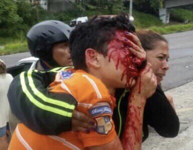 MariaCorinaYA's tweet photo. Hoy, un muchachito de 16 años salió a protestar por falta de gas en Táchira; no quieren cocinar con leña.
PNB los reprimió y lo dejaron CIEGO!!!
Maduro y su régimen criminal ASESINAN la nación...al joven capitán de corbeta, al concejal, al estudiante.
Son nuestros hijos, NO MÁS! https://t.co/1UmOpo7y68
