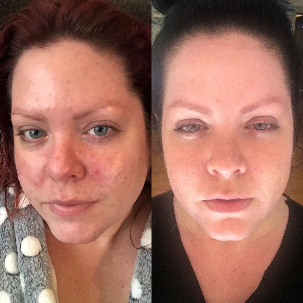 Tria SmoothBeauty Laser Review kristadior.kristardesign.com/2019/07/01/tri…