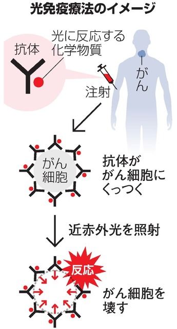 光 免疫 療法 2020