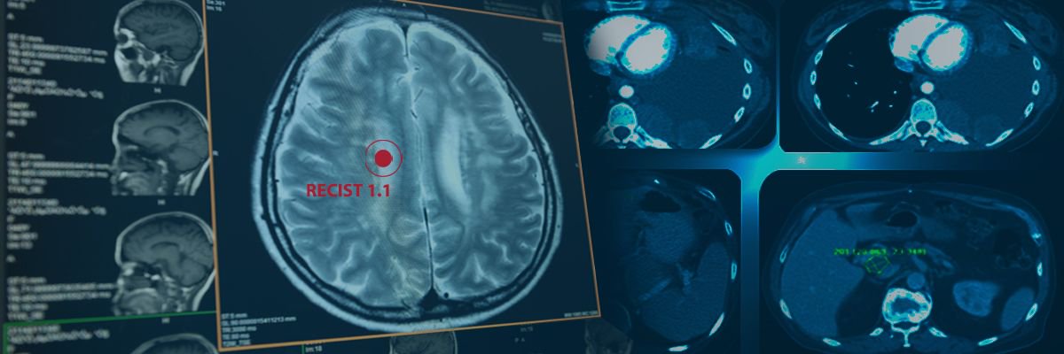 ImageCoreLab's tweet photo. Clinical research at Image Core Labs revolves around 3 basic core strengths which are basic #science, #technology support-innovation and translational research-cum-data analytics...
Read more here: https://t.co/o03yIWIQIK
#ClinicalTrials #DeviceTrials #DeepLearning #AI https://t.co/3YZnaA5NAg