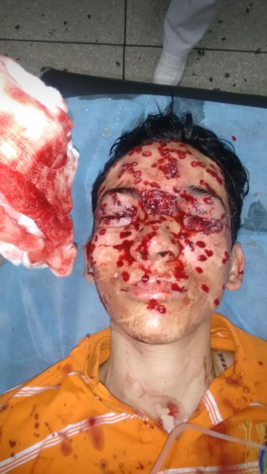 monicacorrales's tweet photo. Quien se atreva a hablar de aquí en adelante de diálogo o elecciones, debe ser catalogado como cómplice de esta barbarie. https://t.co/1htZNUPJ8x