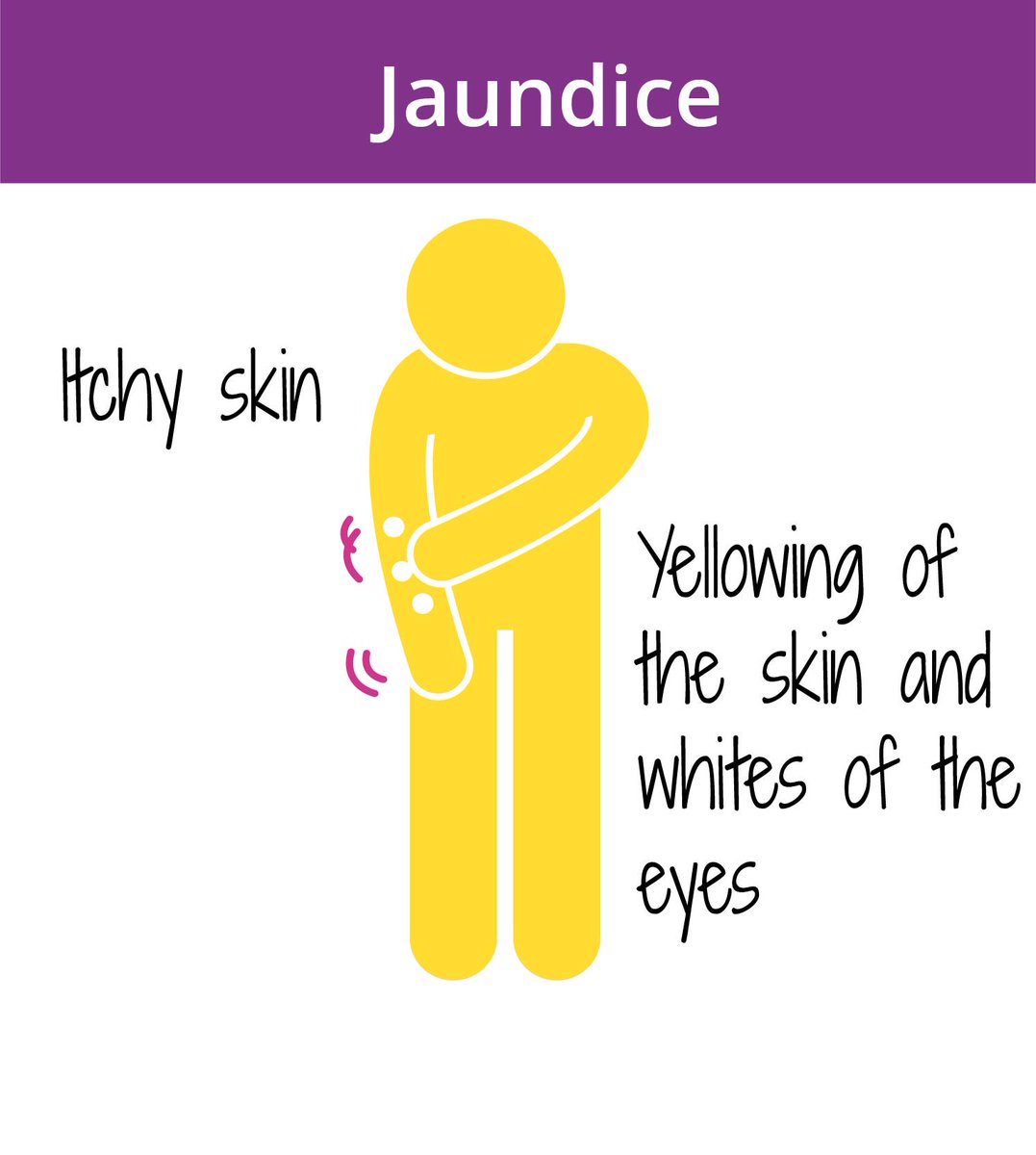 “It is vital to seek urgent medical help, such as going to A&E, if you have #jaundice. Even if the cause is not #cancer, the conditions that can cause jaundice are serious and need to be treated.” #symptomawareness #pancreaticcancer @OfficialPCA