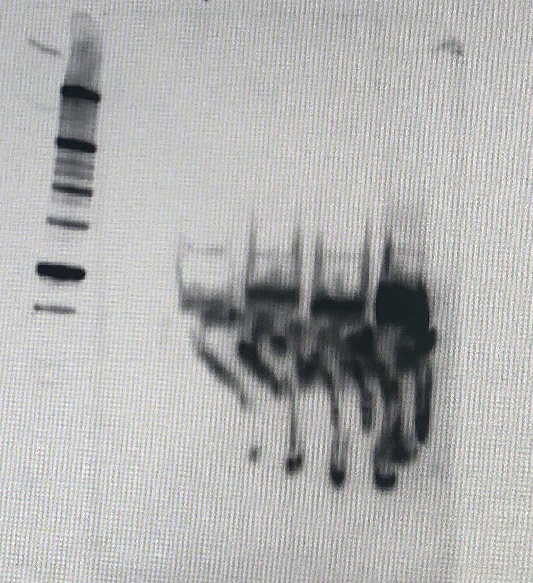 Just when you start thinking that “this will be my last ever #westernblot. EVER”. This happens... Guess I’ll be in the lab tomorrow as well...