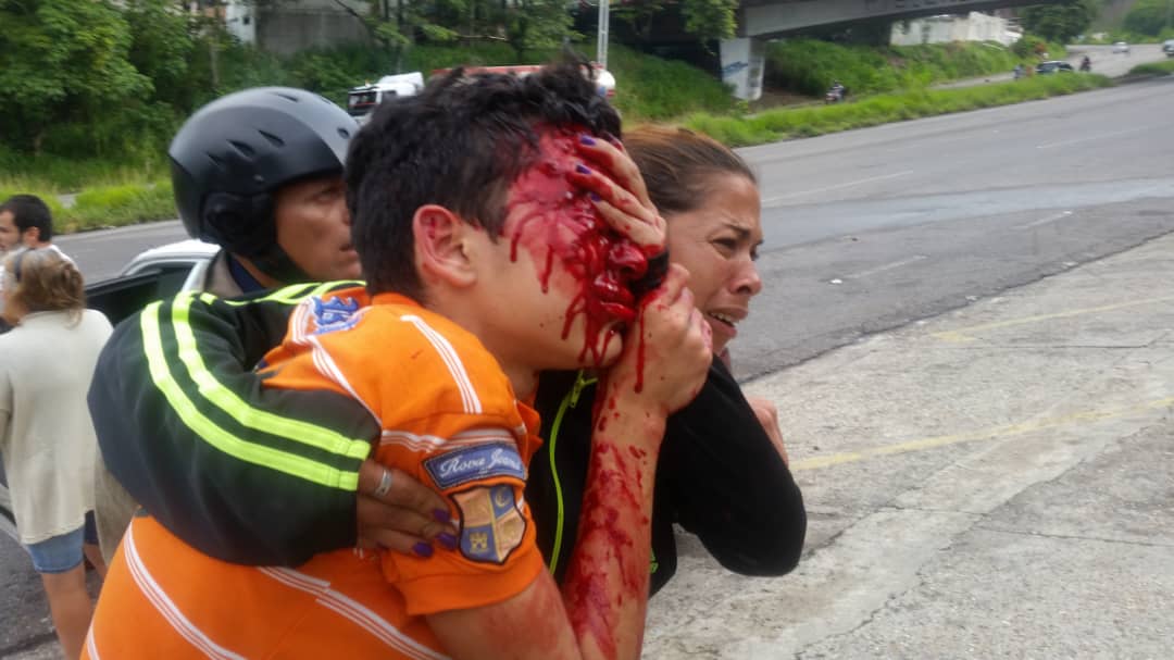 alcaldeledezma's tweet photo. Así son los "diálogos" de Maduro y sus mafias. Van matando mientras aparentan querer resolver la crisis como "pacifistas".
El joven Rufo Velandria fue atropellado salvajemente en Tariba, edo. Táchira. ¡Lo dejaron sin ojos!
Otra víctima más para la cuenta de la narcotirania. https://t.co/vi4QrTKogj