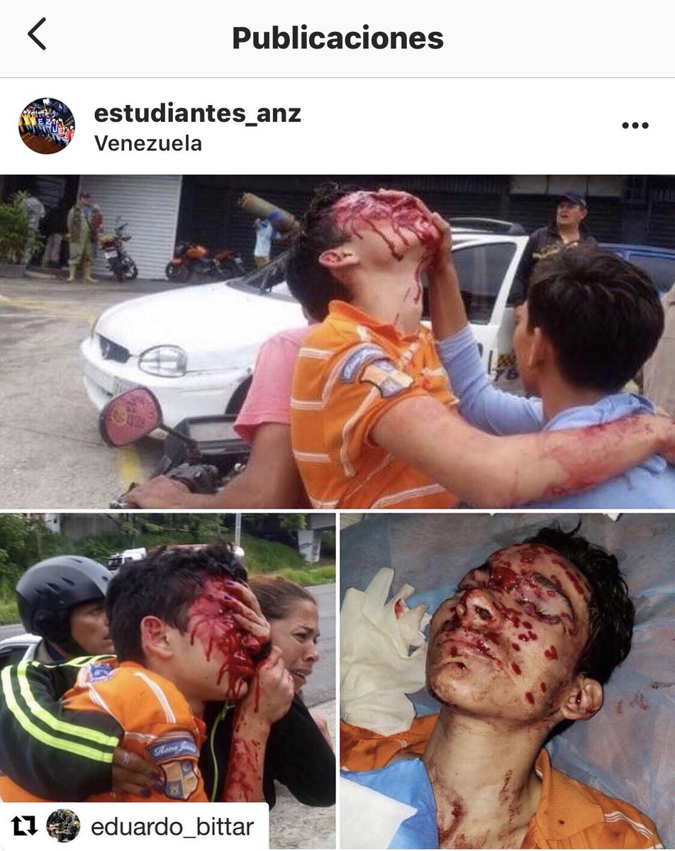 Estudiantes_Anz's tweet photo. NO VAMOS BIEN UN CARAJO... porque mientras otros dialogan y negocian con los chavistas para repartirse el poder a nosotros los estudiantes y al pueblo nos masacran.

#Repost @eduardo_bittar ・・・

El adolescente es estudiante de 5to año del Liceo Luis López Méndez de Táriba. https://t.co/hqhAL7mPaQ