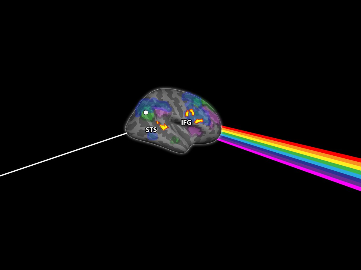 Meytal Wilf (@meytalwilf) on Twitter photo How does visuo-motor prism adaptation change resting state connectivity? check out our new paper on <a href="/NeuroImage_EiC/">NeuroImage</a> to find out how it relates to default mode network and attentional networks connectivity.
sciencedirect.com/science/articl… How does visuo-motor prism adaptation change resting state connectivity? check out our new paper on <a href="/NeuroImage_EiC/">NeuroImage</a> to find out how it relates to default mode network and attentional networks connectivity.
sciencedirect.com/science/articl…