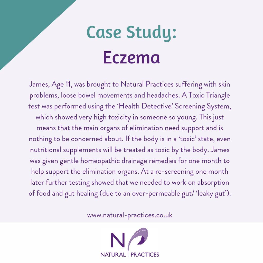NaturalHealthP's tweet photo. Case Study: E C Z E M A
⁣⁣⁠
James, Age 11, was brought to Natural Practices suffering with skin problems, loose bowel movements and headaches.⁣⁣⁠

Read all about his case and how we supported him on his natural healing journey here:

https://t.co/zvimv3L7kX
⁣⁠ https://t.co/92Y6LJKkRS