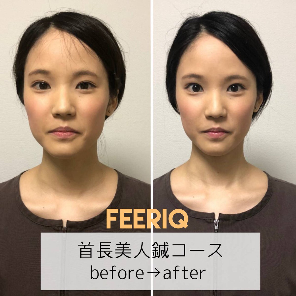 美容鍼灸サロン Feeriq Feeriq Hari Twitter