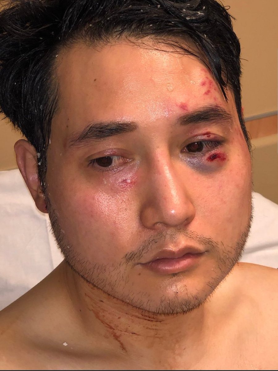 ar15m4mid's tweet photo. If a leftist journalist like @jaketapper @Acosta or @donlemon sustained injuries similar to this by the hands of a mob of Trump supporters, what would the #FakeNewsMedia be saying about it⁉️
#EnemyOfThePeople
#DemocratsHateAmerica
#MobRuleDemocrats https://t.co/jieecAS7u4
