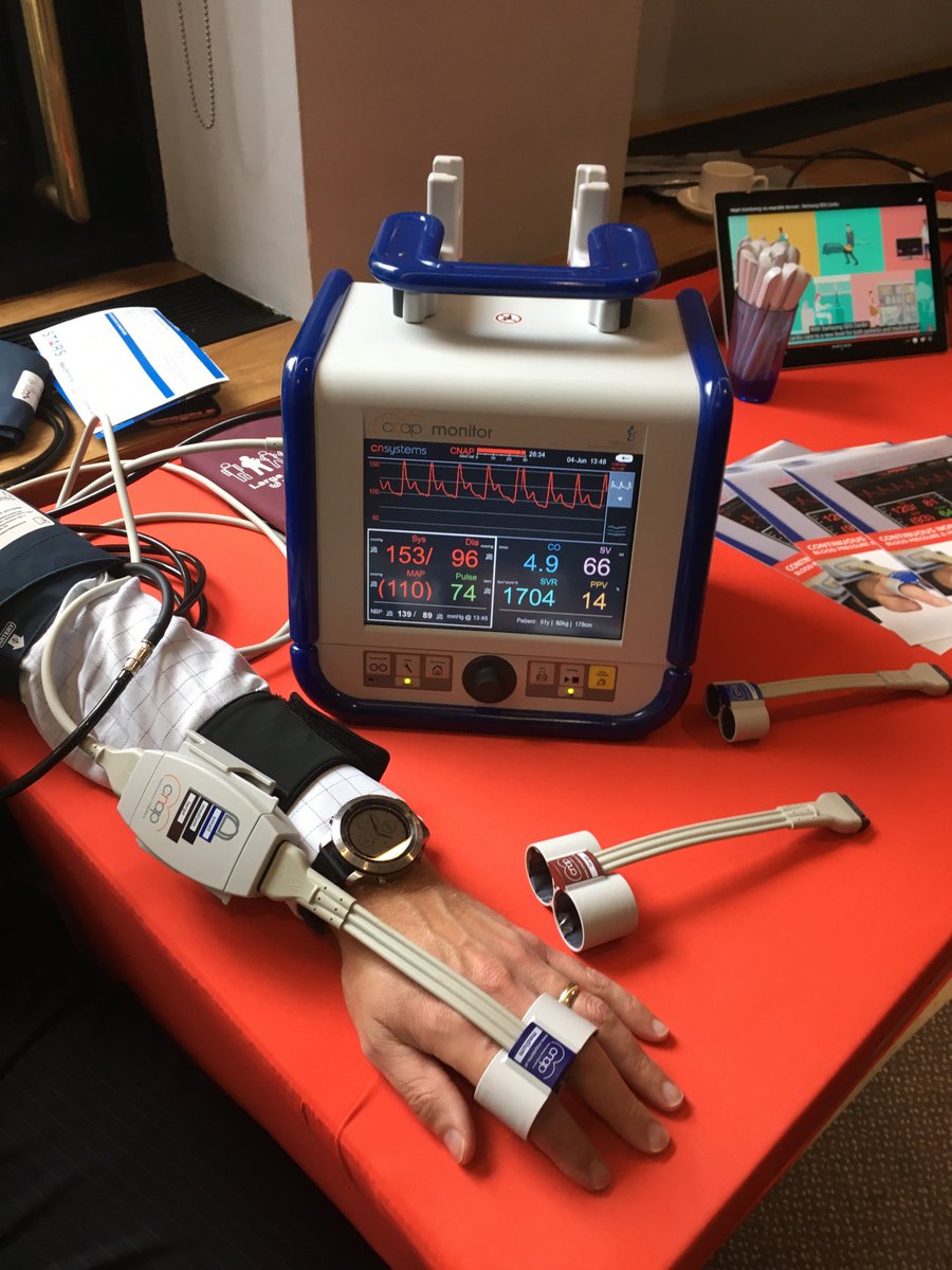 We are at the <a href="/BlackoutsTrust/">STARS - Syncope Trust And Reflex Anoxic Seizures</a> #Syncope #Symposium at Arrowe Park Hospital on Thursday 4th July.  We look forward to welcoming some of you to trial the CNAP and TFM non-monitoring systems from CN Systems.