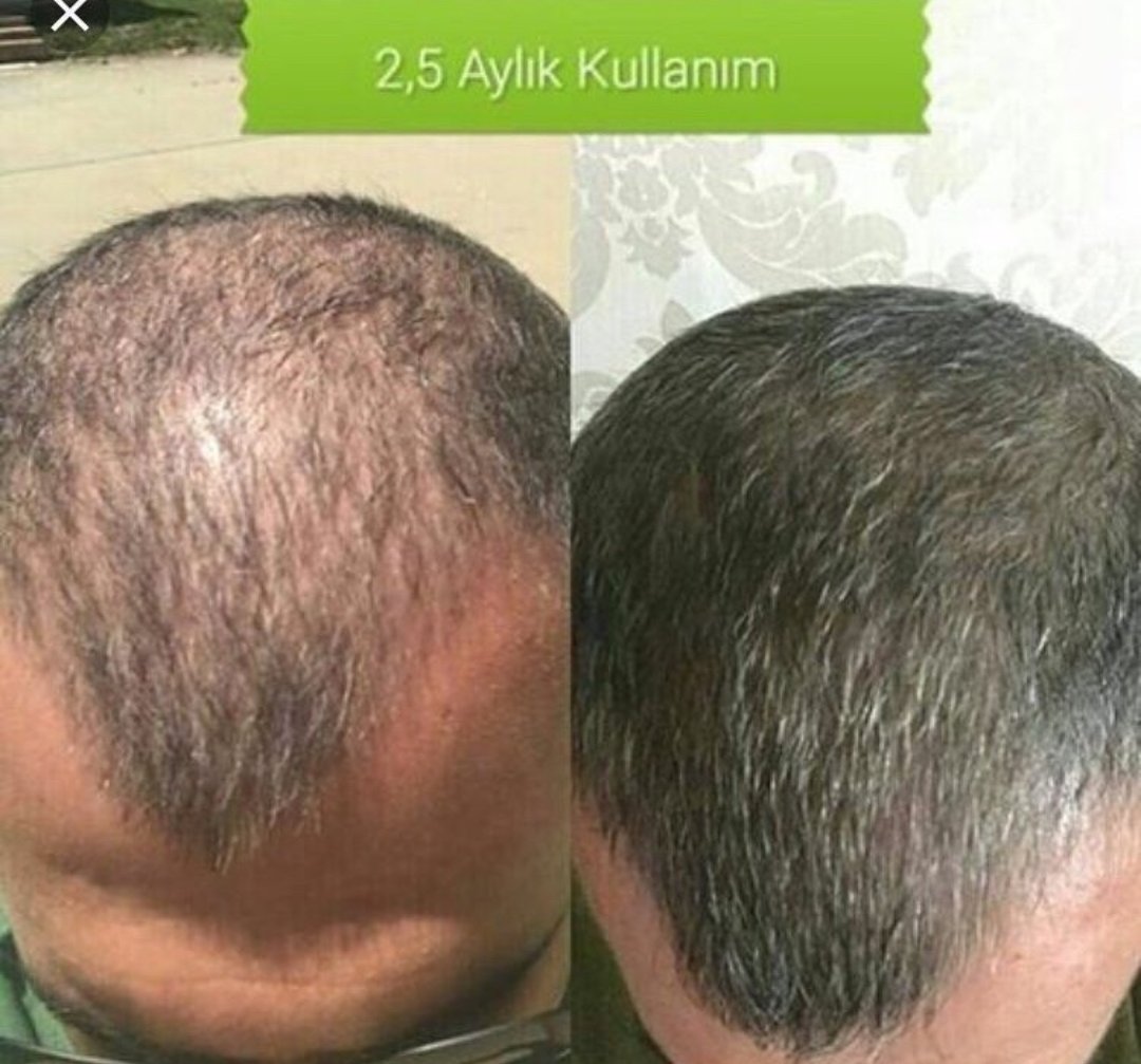 incir_zeytn's tweet photo. #OGANSIA Saç Serumu
kullananlar mutlu ve mesut! 😎
        👇👇👇👇👇👇 https://t.co/vt7521l89q