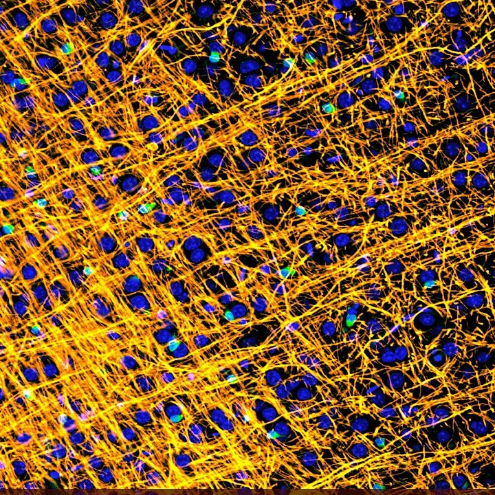 ResearchGlia's tweet photo. Vote for your favourite pics https://t.co/16RkGnFGjZ
VOTING CLOSES TOMORROW AT 12AM BST!
Look at this beauty! Hard wired 😍 👇👇👇👇👇👇👇
@AndreaDomRivera #UoP_Science #UoP #Glia #ResearchMatters #SciArt #Myelin #MSResearch #MSResearchers https://t.co/Qt4fknSek6