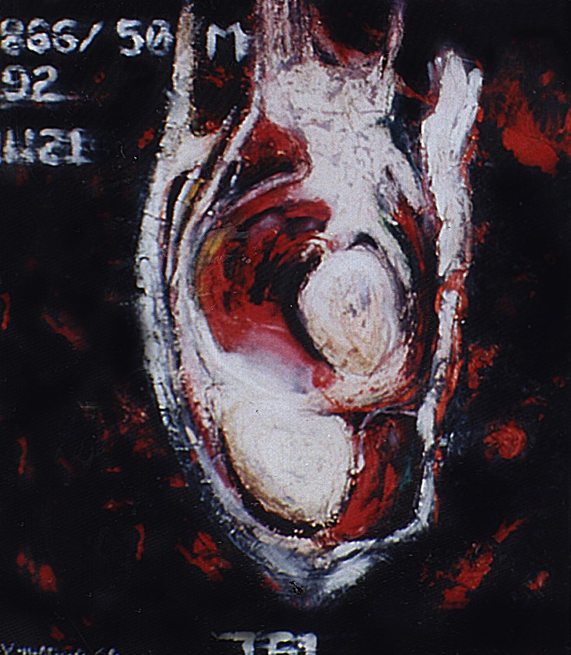 HuacujaVeronica's tweet photo. Title: Coronal Knee Cut
Artist: Veronica Huacuja
Medium: Oil, plastilita with marble powder on canvas
Size: 42.3 x 46.9 x 4 cm
Year: 2000
The artwork intends to poeticize a health condition in human living flesh.#itondo, #artexhibition, #veronicahuacuja, #saachiart, https://t.co/8EafPU9Zwo