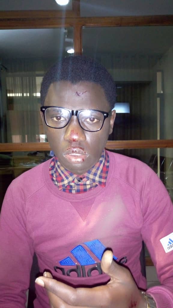 fidele_kitsa's tweet photo. #Goma: Le journaliste @ZanemNety de #Ub_fm et correspondant @politicocd agressé le matin de ce mercredi par des bandits non identifiés au quartier Mabanga à côté du stade de l'unité.
@litshrimp @RSF_inter @rodrah1 @CheckCongo @CongoSauti @kiro_merveilles @habariRDC @tuverwundi https://t.co/DHk2ajGDkZ