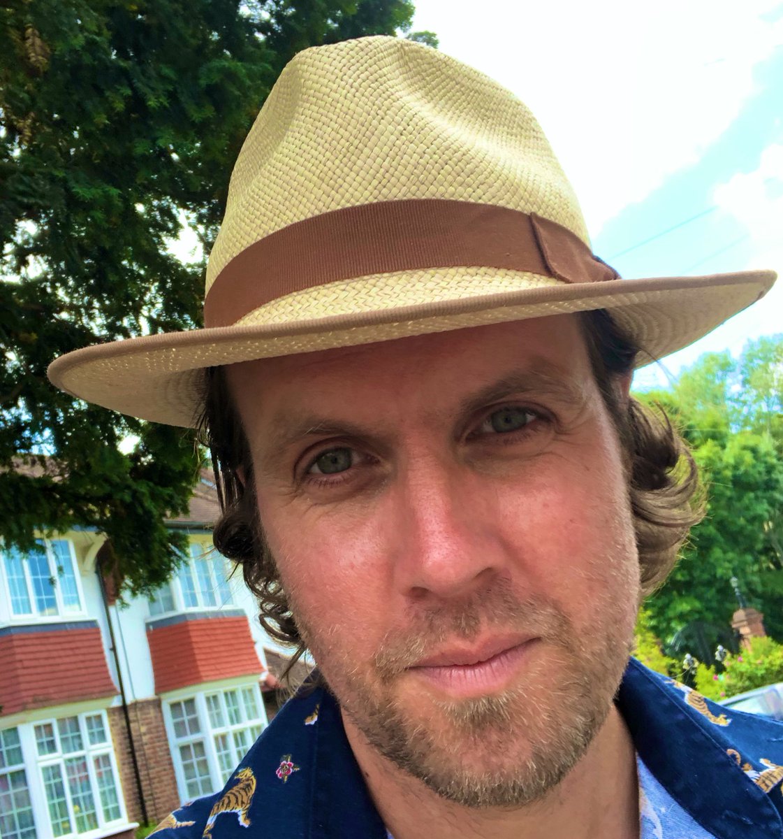 londonglades's tweet photo. In hospital beg of year on deaths door with huge colitis flair up. Emergency surgery, temporary ileostomy etc, thought I was finished. 4mnths on I feel amazing. Just wanted anyone going through that hell to know theres light & new life post surgery. #colitis #ileostomy #chrones https://t.co/l9xOWlI26B