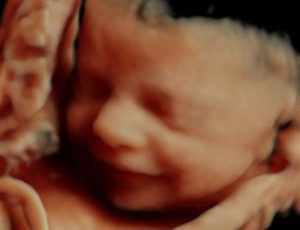 ¡Y por fin tenemos la deseada fecha aproximada para dar la bienvenida a nuestro pequeño Christopher Saul! Está previsto que llegue en la semana del 19 al 25 de agosto. Hoy nos ha sonreído y saludado, hoy estamos un poco más cerca de él. 👣🤰🏼#BabyBrowly