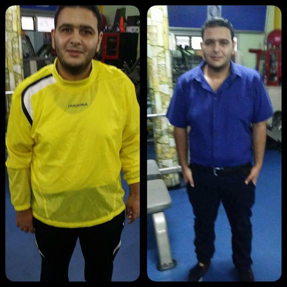 so000so_79's tweet photo. #الًوًاًتٍسًاًبً_مًًعًٍلًًق
أُحصل على مجموعة كلين 9

تحدي وزنك خلال👈 21 يوم وإخسر 15 كيلو

المنتج الأول في العالم والأقوى🏅 💪🏻

 ينظف  يطهر  يحرق الدهون☘ 

📞 التوصيل للبيت🚛 الدفع بعد الاستلام🎁 

للطلب رابط الواتس اب في اول تعليق https://t.co/5USrz3LLX2