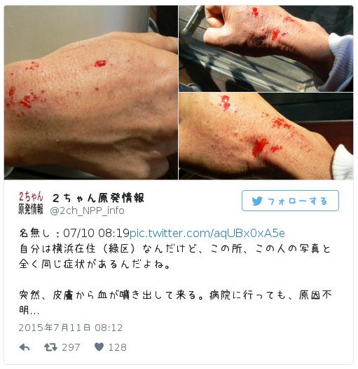 בטוויטר そうか エボラは被ばく症状に似てるからか T Co Ykctmwylcf T Co Bnzqq5xdr3 טוויטר בטוויטר そうか エボラは被ばく症状に似てるからか T Co Ykctmwylcf T Co Bnzqq5xdr3 טוויטר