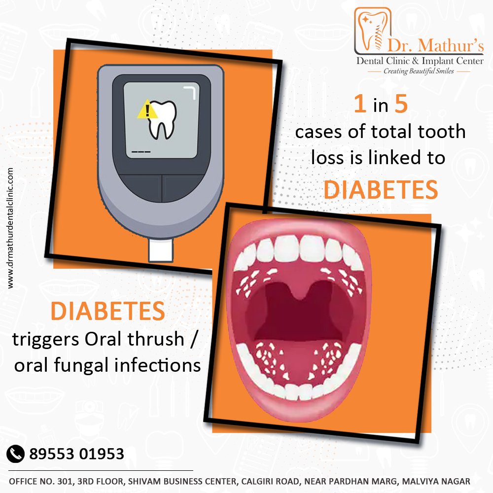 MathurClinic's tweet photo. If you are a person living with diabetes, and wish to prevent tooth and gum problems give us a call +91 8955301953

#OralHealth #Diabetes #Infection #FungalInfection #Glucose #DrMathurs #DentalHealth #Jaipur https://t.co/D6qSoLLsrz