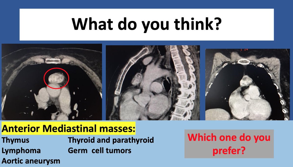 teachingradiol1's tweet photo. Thoracic radiology #foamrad #foamradiology #abdominalradiology #edir #test #quiz #thorax https://t.co/8rmnOyHTGR