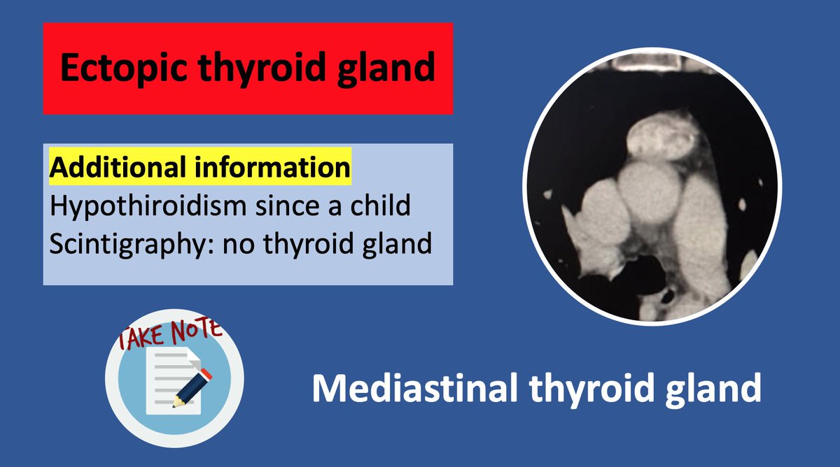 teachingradiol1's tweet photo. Thoracic radiology #foamrad #foamradiology #abdominalradiology #edir #test #quiz #thorax https://t.co/8rmnOyHTGR